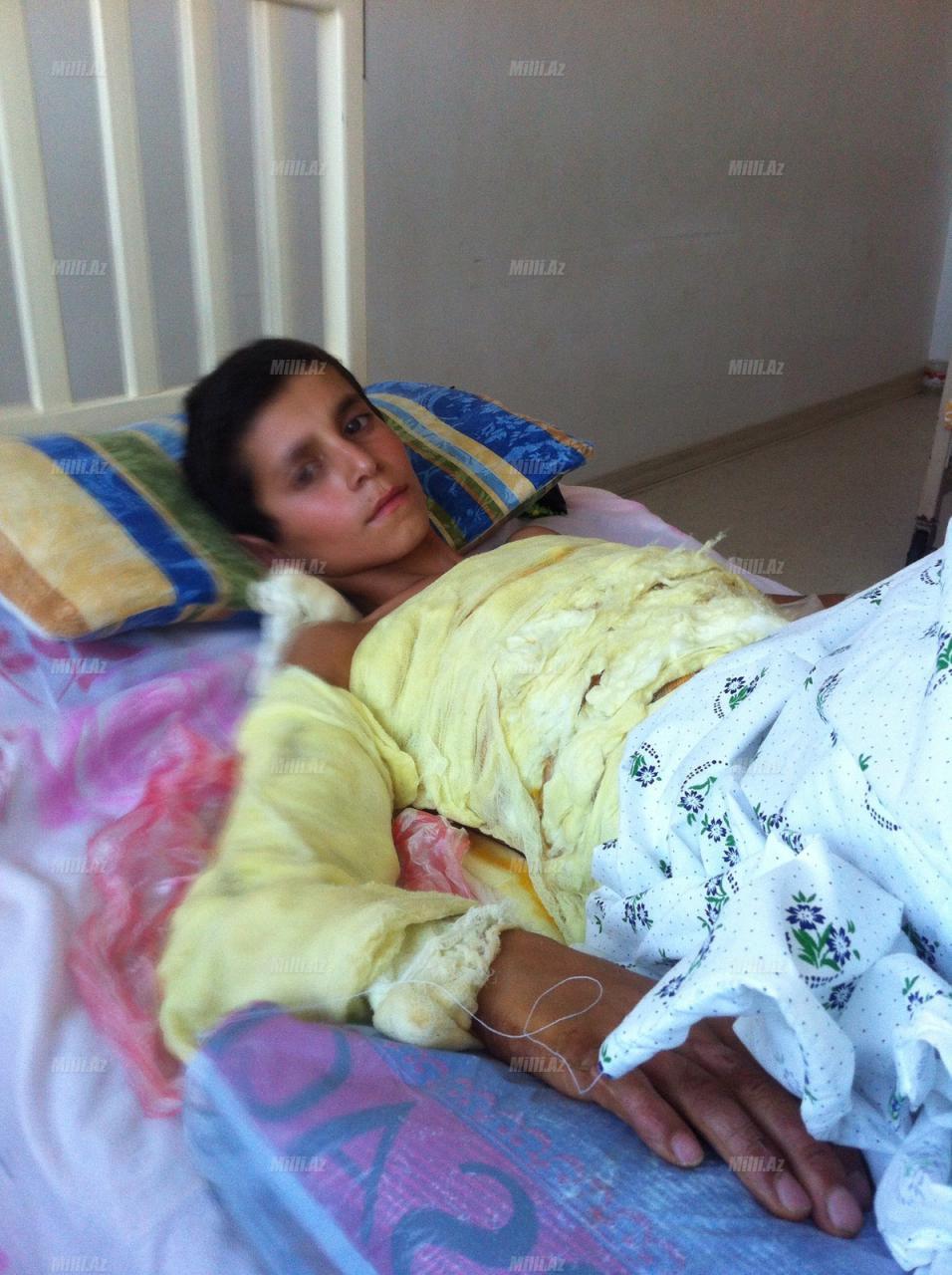 Uşaq ana ocağında yandı, pulsuzluq isə ailəni odlayır - YENİLƏNİB - FOTO