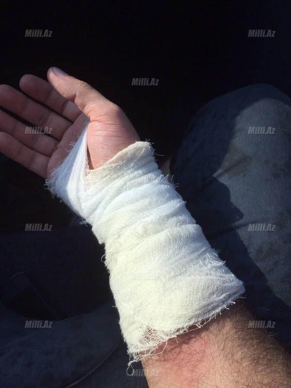 Dj Çina ağır qəzaya düşdü - YENİLƏNİB - FOTO