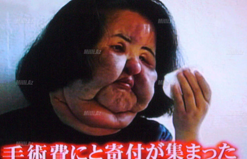 Gözəl olmaq istədilər, eybəcərləşdilər - FOTO