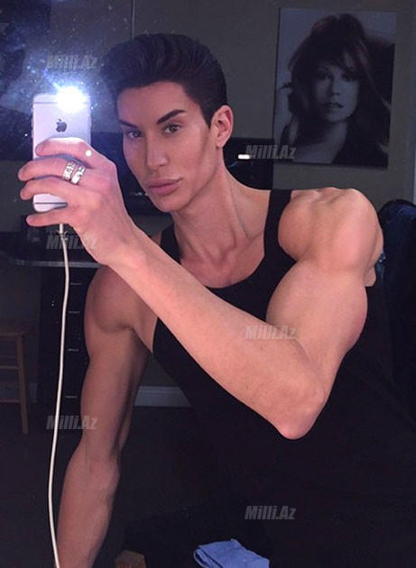 Gözəl olmaq istədilər, eybəcərləşdilər - FOTO