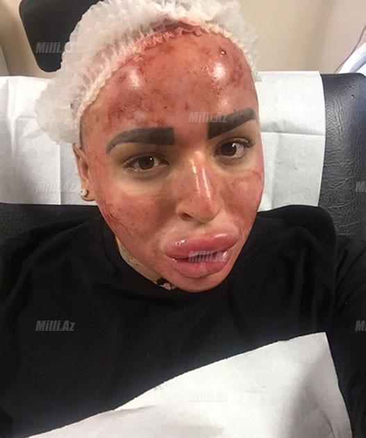 Gözəl olmaq istədilər, eybəcərləşdilər - FOTO