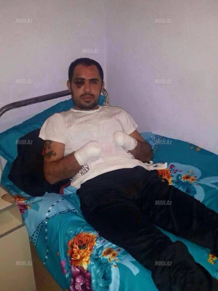 Borca görə əlləri kəsilən şəxsin FOTOsu yayıldı