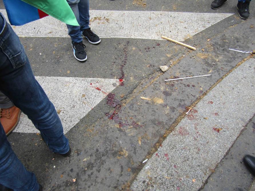 Ermənilərlə PKK tərəfdarları soydaşlarımıza hücum etdi - YENİLƏNİB - VİDEO - FOTO