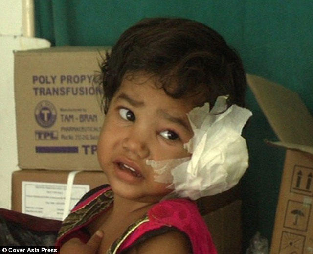 Körpənin qulağından çıxanlar həkimləri ŞOK ETDİ - FOTO