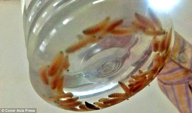 Körpənin qulağından çıxanlar həkimləri ŞOK ETDİ - FOTO