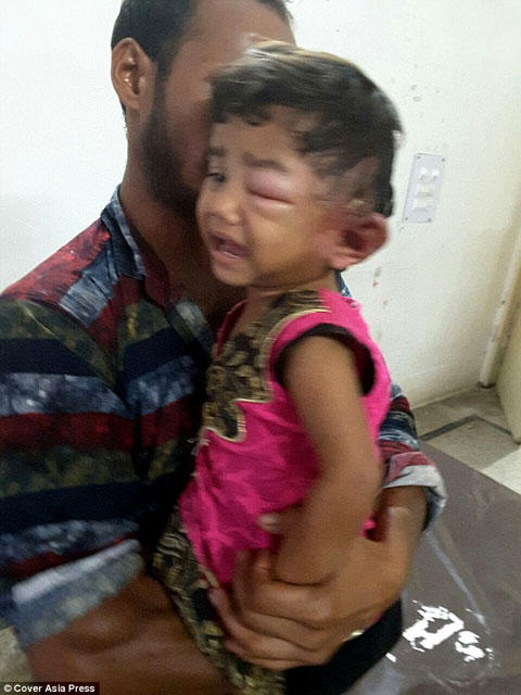 Körpənin qulağından çıxanlar həkimləri ŞOK ETDİ - FOTO