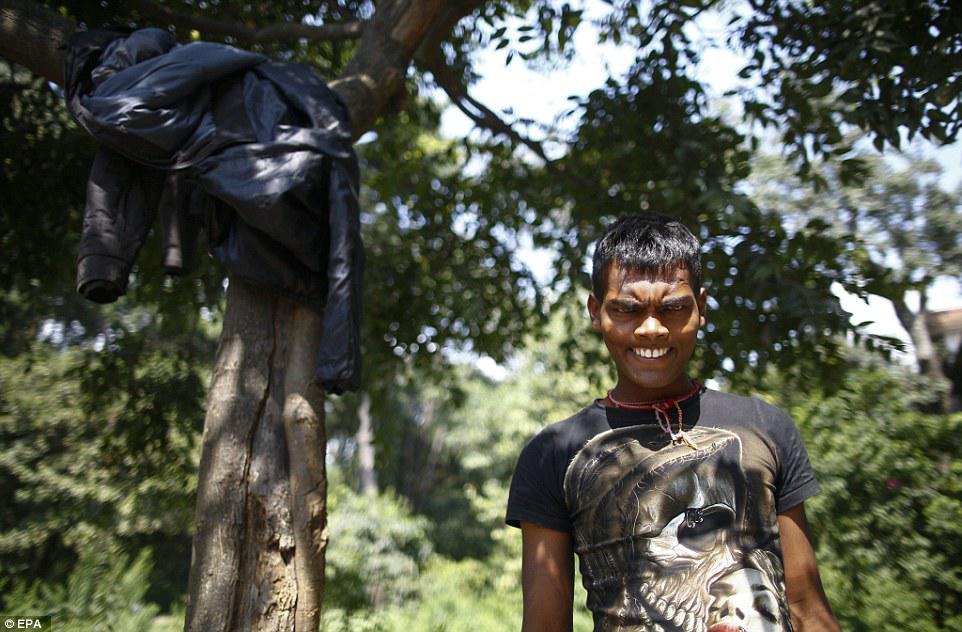 Yapışqan iyləyib şikəst qalan gənclər - FOTO