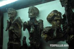 Bakıda təpəgöz, iki-üç başlı uşaqlar, siam əkizlərinin saxlandığı otaqlar - FOTO