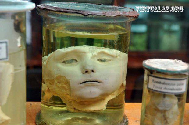 Bakıda təpəgöz, iki-üç başlı uşaqlar, siam əkizlərinin saxlandığı otaqlar - FOTO