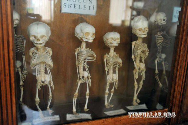 Bakıda təpəgöz, iki-üç başlı uşaqlar, siam əkizlərinin saxlandığı otaqlar - FOTO