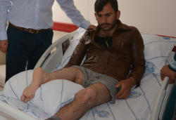 Həkimlər ayağını tərs tikdilər - FOTO