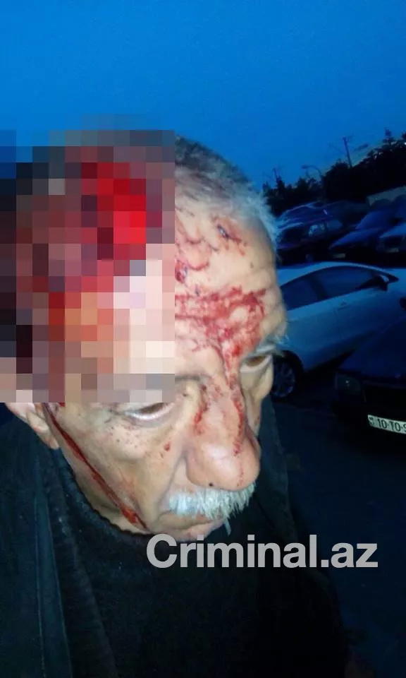 Bakıda vəhşilik: Yaşlı kişini armaturla döydülər - FOTO