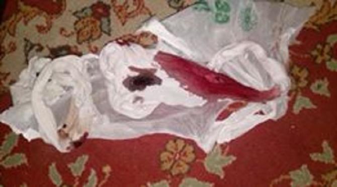 Azərbaycanda kişi arvadını çılpaq soyundurub bıçaqladı - FOTO