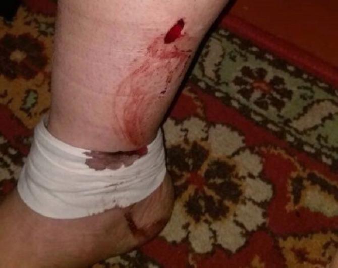 Azərbaycanda kişi arvadını çılpaq soyundurub bıçaqladı - FOTO