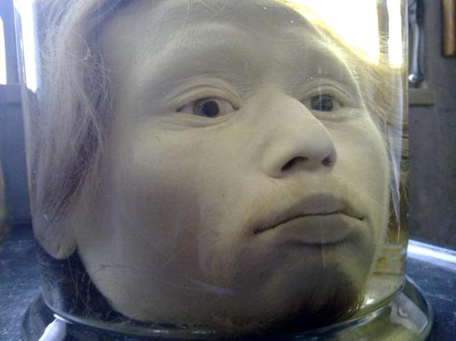 Öldürdüyü şəxsin cəsədini 170 hissəyə ayıran qatilin başını bankada saxlayırlar - FOTO