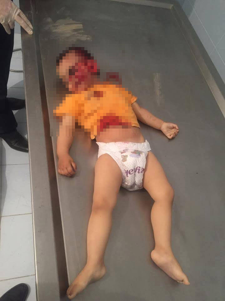 Ermənilərin öldürdüyü 2 yaşlı Zəhranın FOTOları