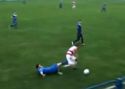 Futbolçu elə yerindən zədə aldı ki, <span class="color_red">ömürlük bədbəxt oldu - VİDEO - FOTO</span>