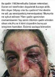 Şəkli yayılan döyülmüş qadın əslində kimdir? - FOTO +18