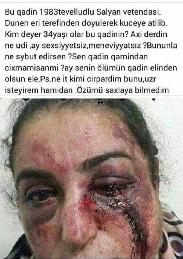 Şəkli yayılan döyülmüş qadın əslində kimdir? - FOTO +18