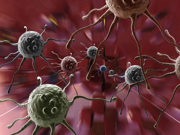 Zərərsiz bildiyimiz vərdişlər xərçəngə aparır - Onkoloqdan xəbərdarlıq