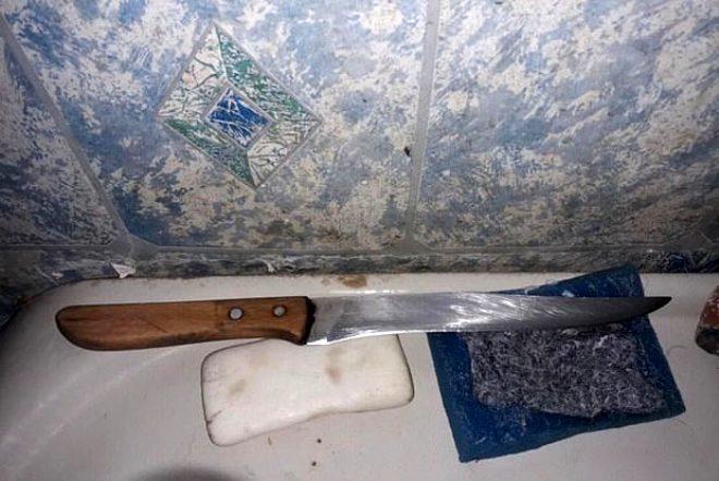 Qayınana kürəkəninin cinsi orqanını kəsib pəncərədən atdı: sonra 27 dəfə... - FOTO
