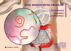 Kiçik qurdun böyük fəsadları