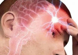 Miqren tutması zamanı nə etməli? - Həmin gün üçün vacib tövsiyələr