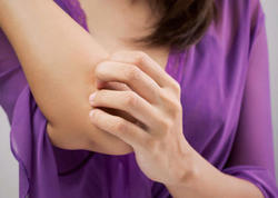 Dəri niyə qaşınır? – 15 ən yayılmış səbəb