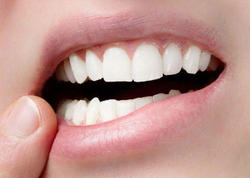 Diş itkisi ölüm riskini artıra bilər - ARAŞDIRMA