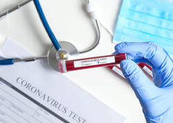 "COVID"dən sonra itən iybilmə hissi bu üsulla bərpa oluna bilər