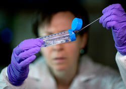 Peyvəndi və müalicəsi olmayan virus yayılır