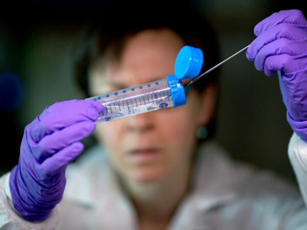 Peyvəndi və müalicəsi olmayan virus yayılır