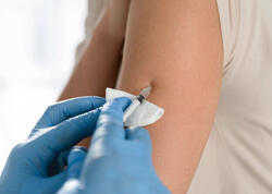 Azərbaycanda bu şəxlər peyvənd OLUNACAQ - RƏSMİ