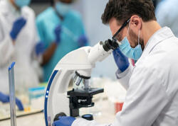 Sayır, hadisələri qeyd edir: Üstəlik, bütün bunları "beyni" olmadan bacarır