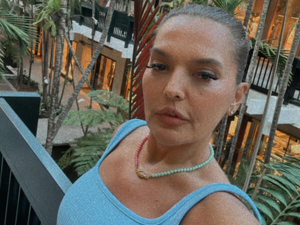 "Hamısı iynə ilə arıqlayıb, İNANMAYIN" - <span class="color_red">FOTO</span>