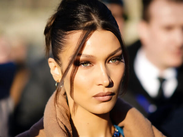 Bella Hadidin xəstəliyi kəskinləşdi: Evdən çıxa bilmir