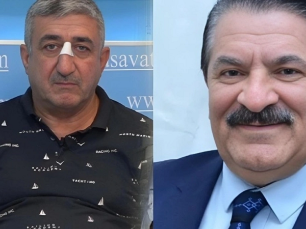 Ağadadaşın balta atdığı mühafizəçi qatarda əxlaqsız hərəkət edibmiş
