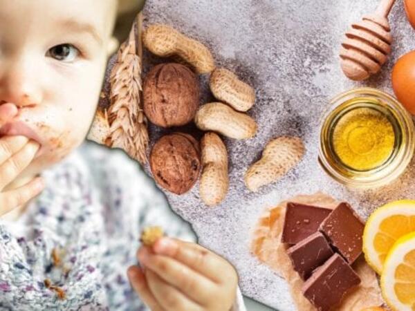 Uşağınızda qaşınma, qızartı, səpki varsa, bu qidaları verməyin