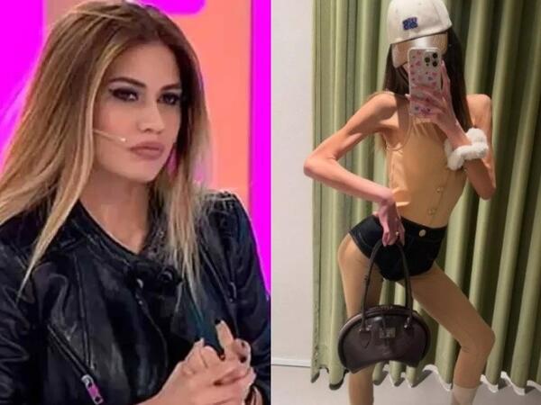 Çəkisi 37 kiloqrama düşən Nihal Candanın son halı - <span class="color_red">FOTO</span>