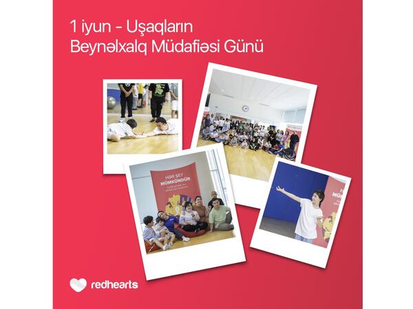 Hər şey mümkündür: Daun sindromlu uşaqlar üçün sosial layihə