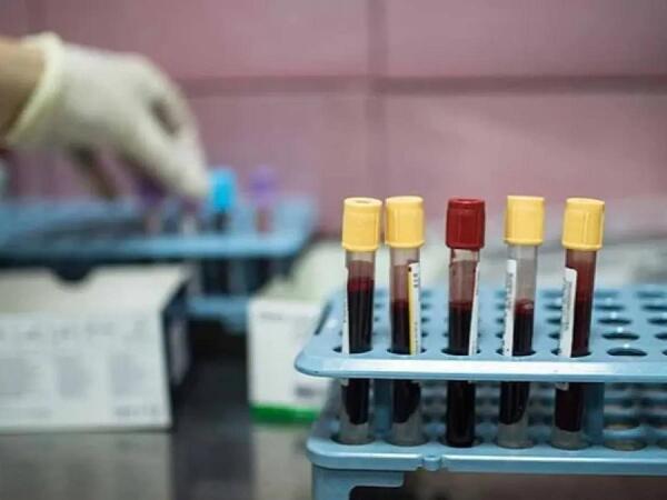Xərçəngin bu növü Y nəslinin yeni kabusuna çevrilib