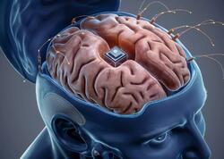 İnsan-beyin interfeysi reallığa çevrildi – &quot;Neuralink&quot;dən uğurlu nəticələr