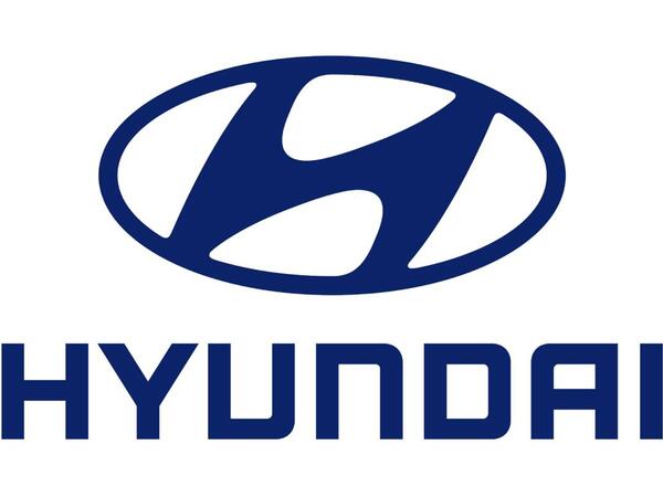&quot;Hyundai&quot;nin bu modelində ciddi zavod qüsuru aşkarlandı - Partlayış ola bilər - VİDEO
