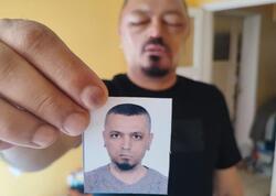 İnternetdən aldığı şampun həyatını kabusa çevirdi - FOTO