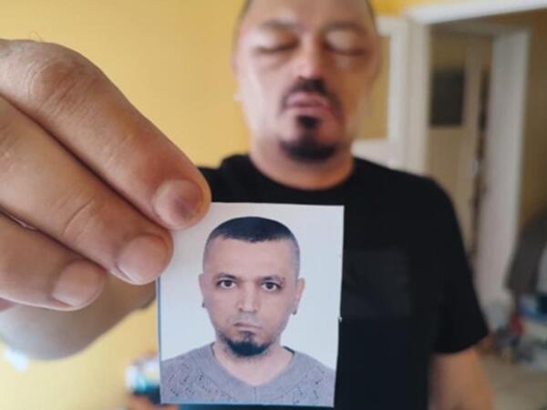 İnternetdən aldığı şampun həyatını kabusa çevirdi - FOTO