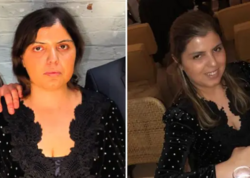 Xərçəngdən sağalan qız həşərat dişləməsindən öldü - FOTO