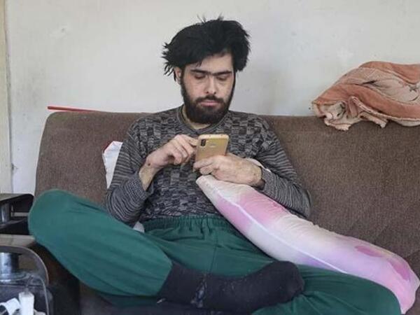 Bu oğlan 3 ildir evdən çıxmır: &quot;Əlimdə olsa tualetə də getmərəm&quot; - FOTO