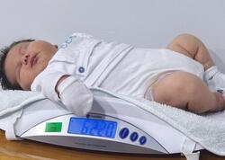 6 kilodan çox doğulan körpə gündəm oldu - <span class="color_red">FOTO</span>