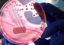 Kişilərdə ən çox rast gəlinən ikinci xərçəng növü hansıdır?