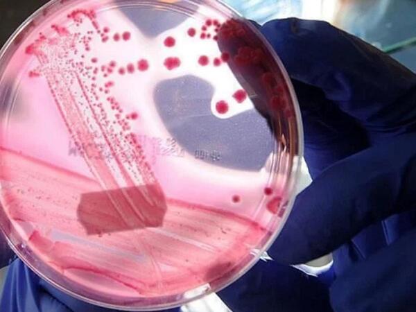 Kişilərdə ən çox rast gəlinən ikinci xərçəng növü hansıdır?